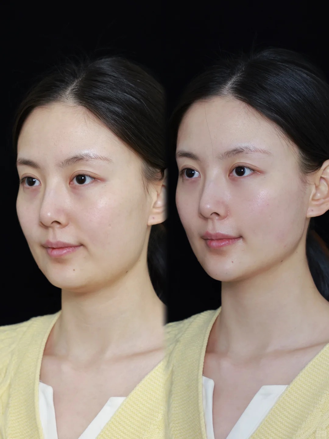 Signature Uplift bridal facial